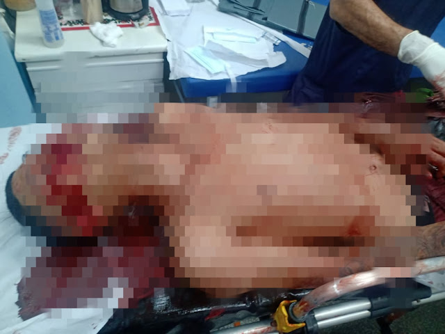 Tiroteio durante jogo do Flamengo deixa mortos e feridos na Zona Leste ; assista