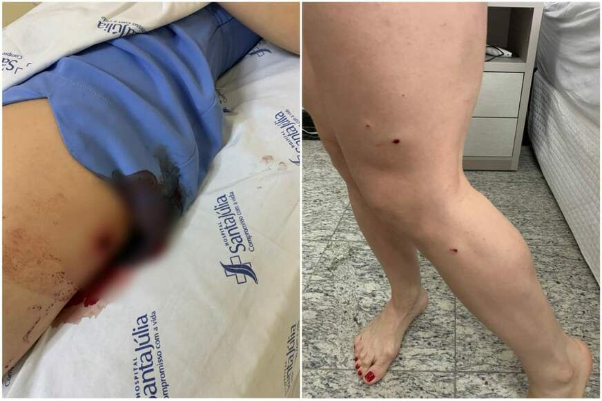 Delegado pede prisão preventiva de dono de funerária que tentou matar sócia e funcionário