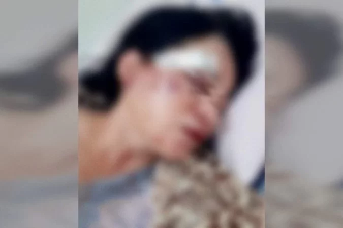 Mulher é espancada por 9 vizinhos após denúncia de som alto