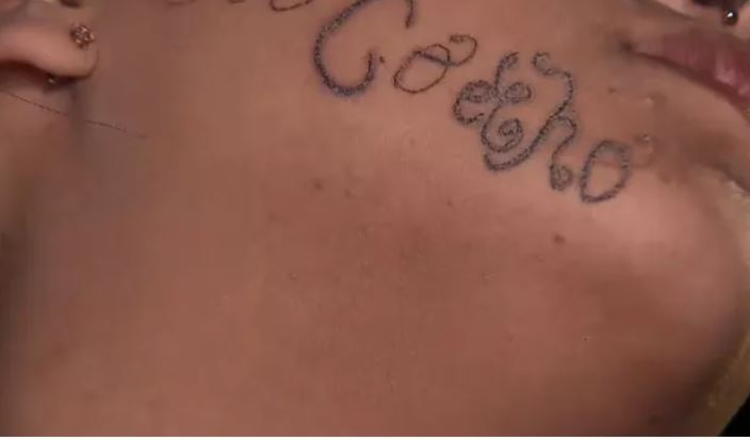 Homem agride ex-namorada e tatua nome no rosto dela