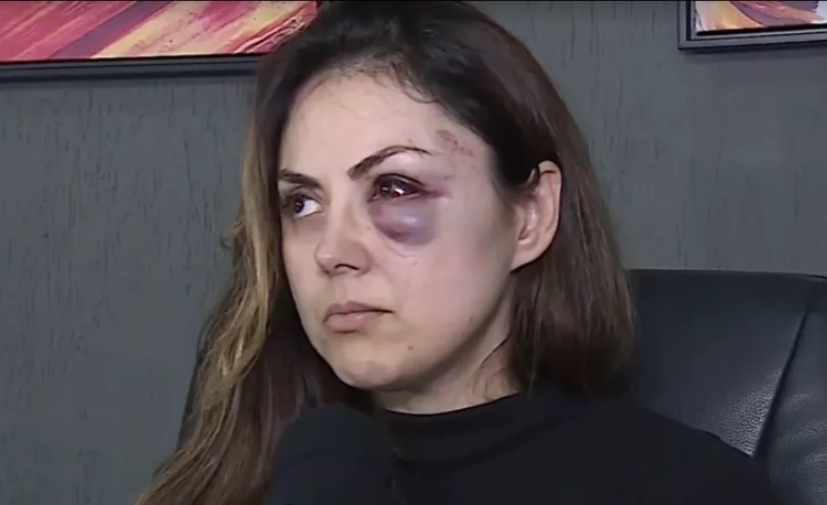 Homem que espancou procuradora é suspenso e tem salário cortado