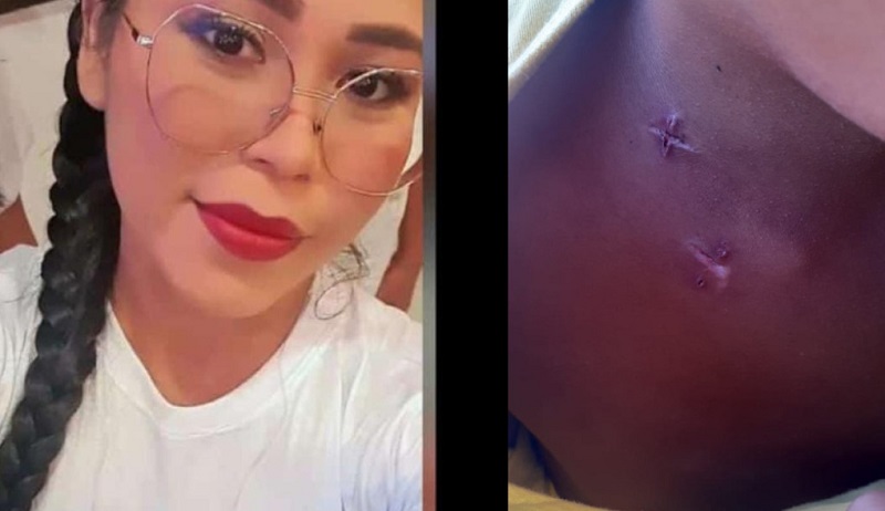 Morre mulher que foi esfaqueada e teve corpo queimado em incêndio causado pelo ex no AM