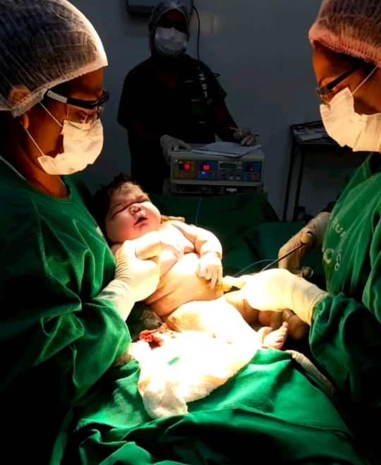 Nasce ‘super bebê’ com mais de sete quilos no interior do AM
