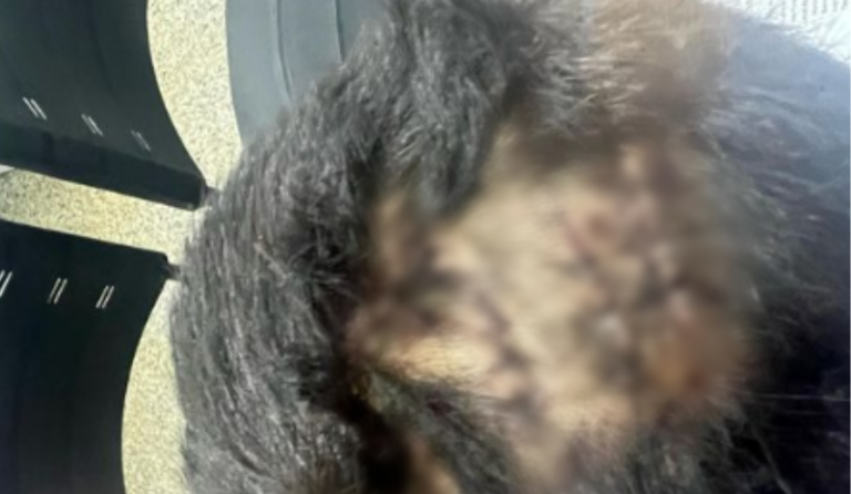 Criança tem cabeça quebrada após comer o mingau da irmã em Manaus