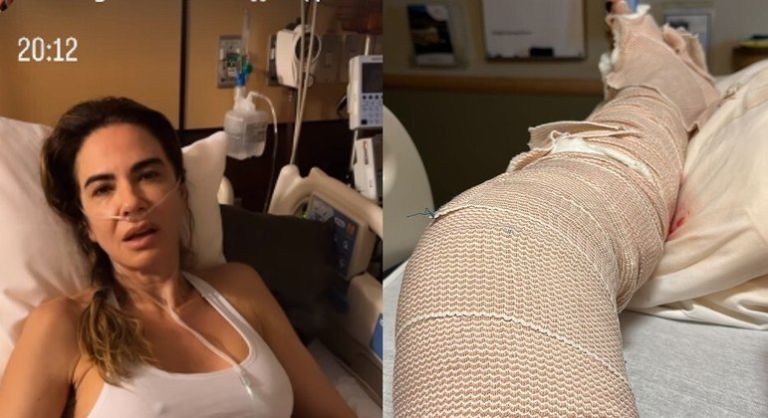 Luciana Gimenez mostra perna enfaixada e desabafa: ‘Muita dor’