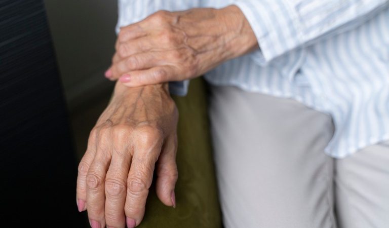 Saúde: osteoporose pode evoluir sem sintomas e aumentar o risco de fraturas